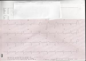 ECG-1