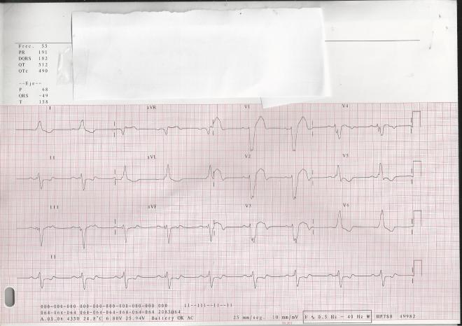 ECG-1