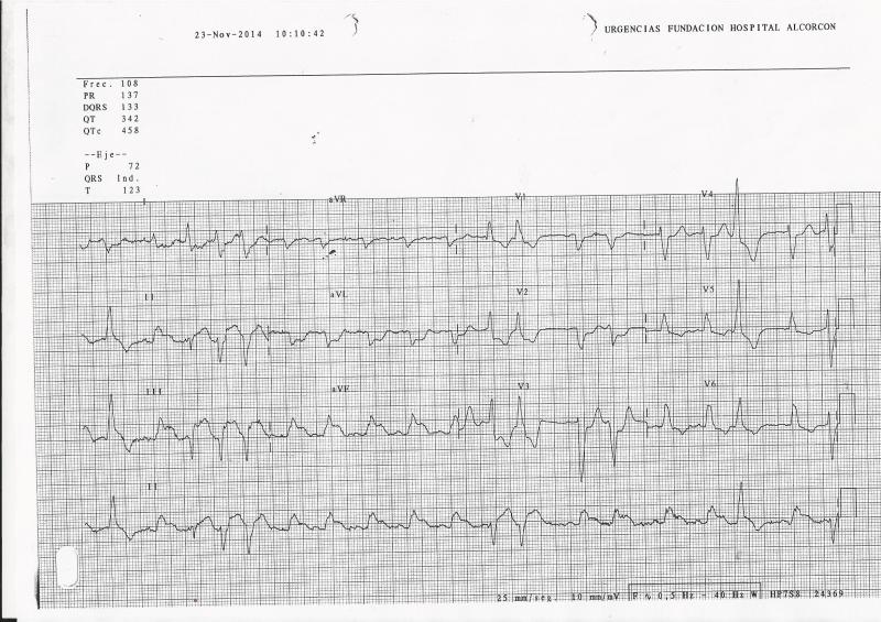 ECG-IAM-BRI-3