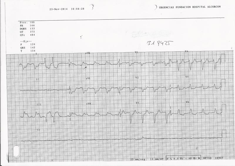 ECG-IAM-BRI-URG2