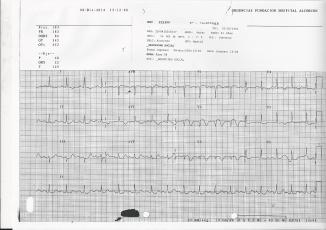 IAM SUB URG-ECG