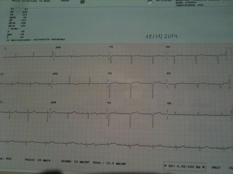 ECG-IAM-215774JPG