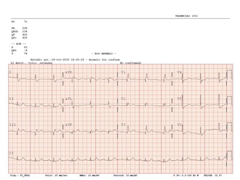 ECG-URGENCIAS
