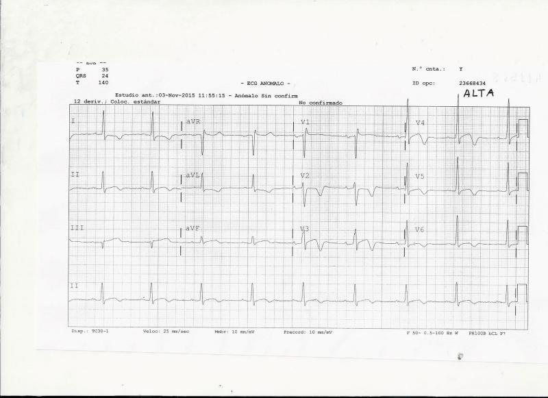 ECG-ALTA-1