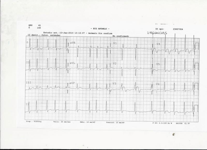 ECG-URGENCIAS-1