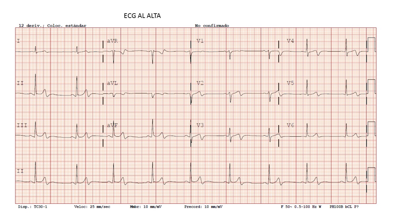 IAM anterior-939516-alta