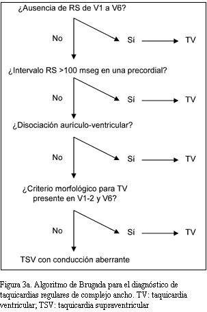 algoritmo-de-brugada