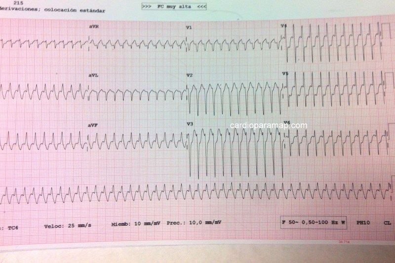 flutter-auricular-2-949854