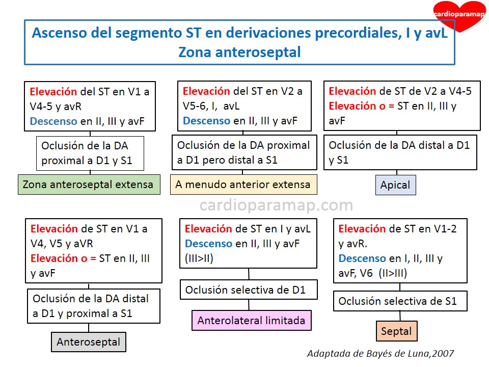 Localiza la arteria del infarto-zona anteroseptal