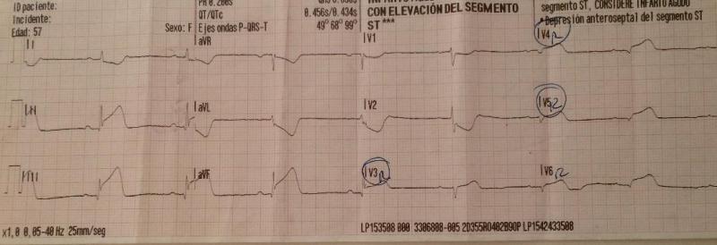 IAM INFERIOR ELEVACIÓN V4R