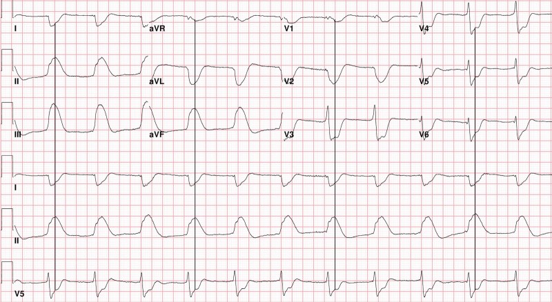 SHARK-FINE-WITH-LINES-FINAL ECG