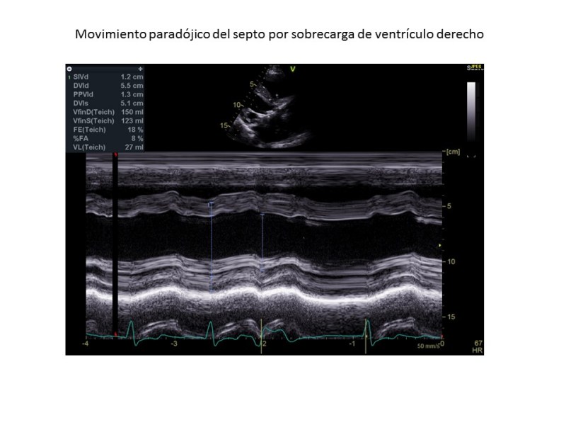 Diapositiva3